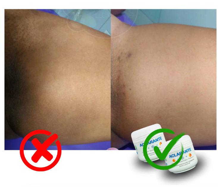 CREMA ACLARANTE 2 X 1