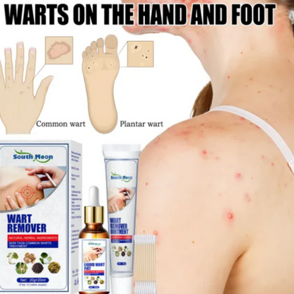 KIT 2X1🔥 WART BLACKHEADS® │Removedor automatico de verrugas│⭐⭐⭐⭐⭐