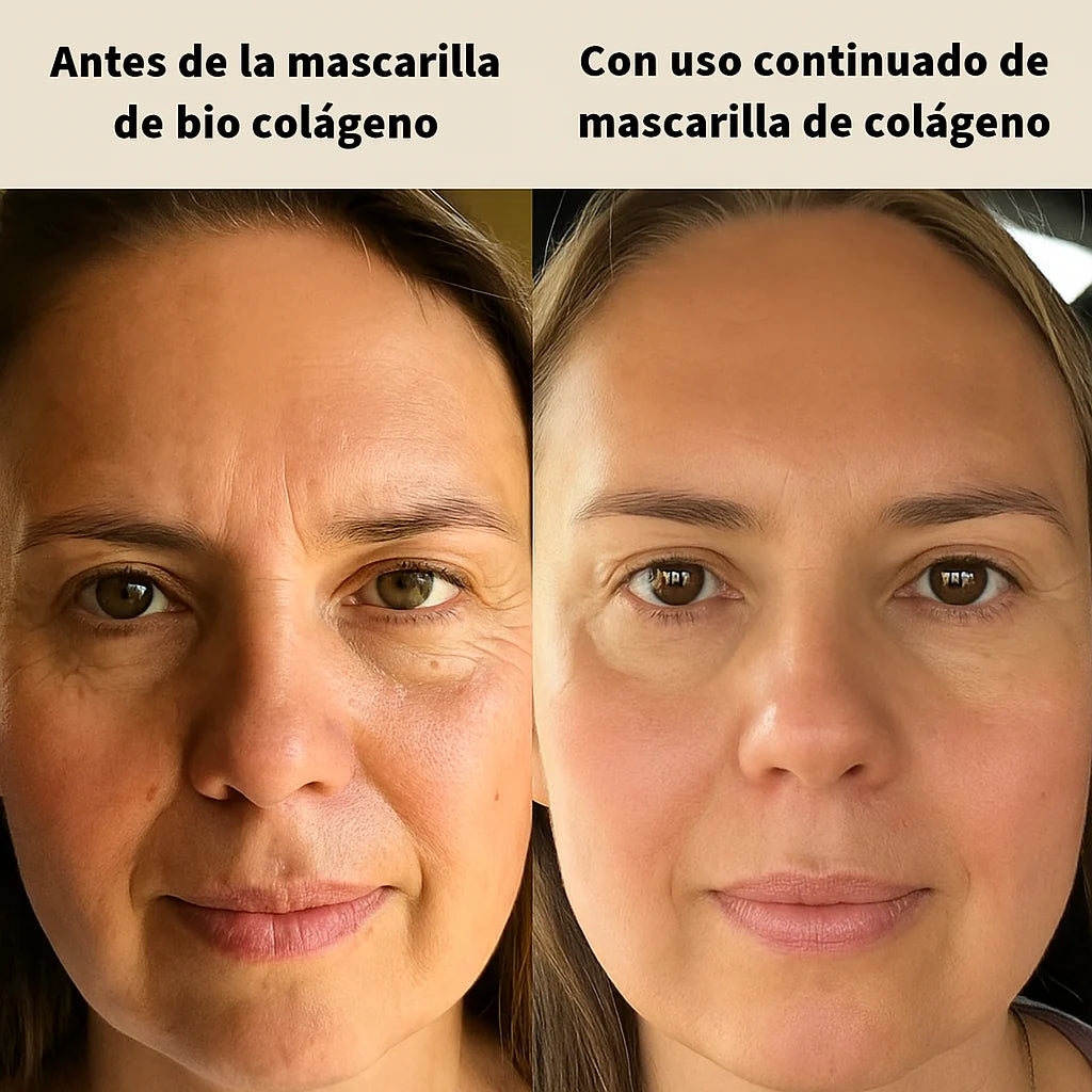 ¡Oferta Limitada! PACK de 5 UNIDADES✨ Mascarilla Reafirmante Antiarrugas (Colágeno Profundo)💆‍♀️