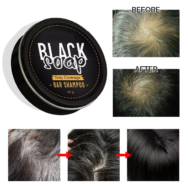 BlackSoap™ Jabón Anticanas