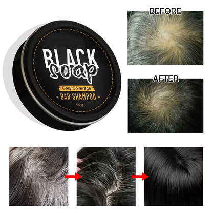 BlackSoap™ Jabón Anticanas