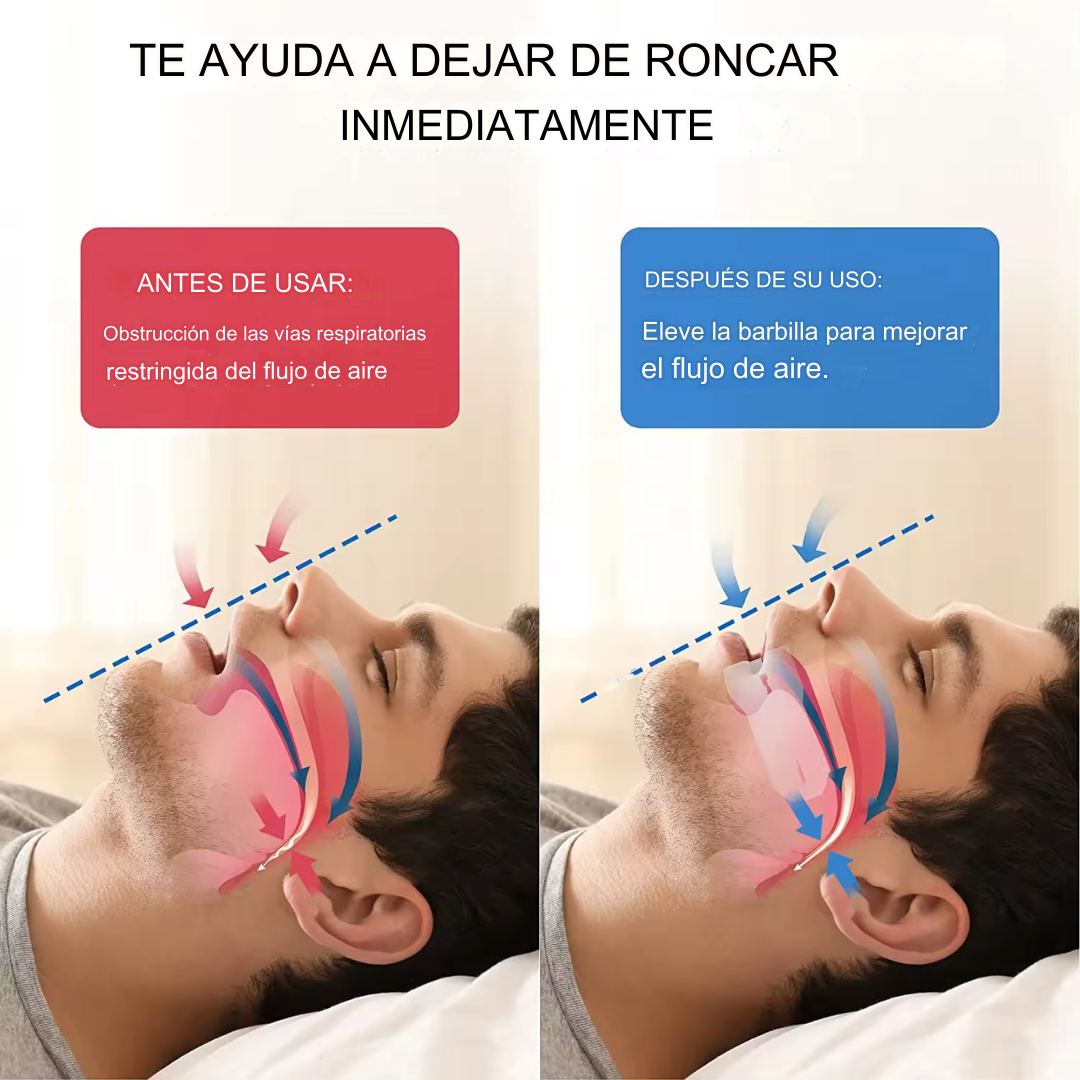 PLACA DE MORDIDA CONTRA RONQUIDOS 💤🚀