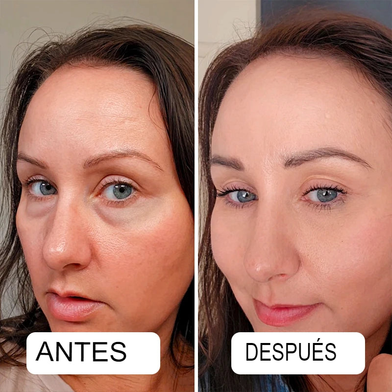 🌟✨ LumiLift™ – Tu Ritual Diario para una Piel Joven y Radiante 💆‍♀️💖