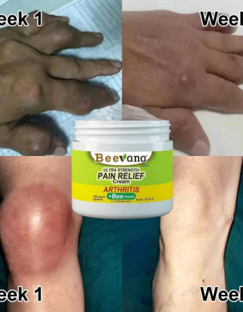 Beevana™ Crema del Dolor 🐝¡PROMOCIÓN 2 UNIDADES!🐝